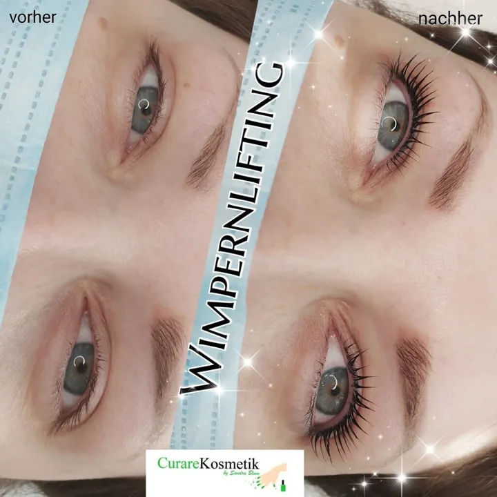 Wimpernlifting, vorher und nachher